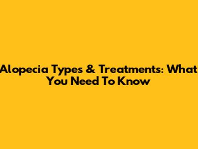 Alopecia Types & Treatments: What You Need To Know