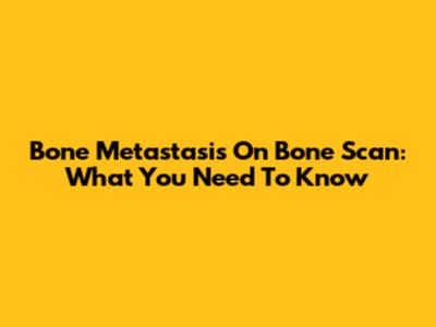 Bone Metastasis On Bone Scan: What You Need To Know