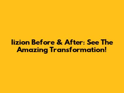Iizion Before & After: See The Amazing Transformation!