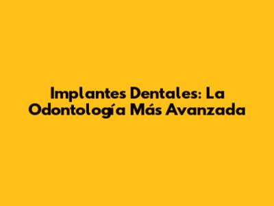 Implantes Dentales: La Odontología Más Avanzada
