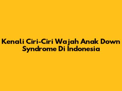 Kenali Ciri-Ciri Wajah Anak Down Syndrome Di Indonesia