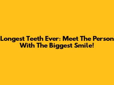 Longest Teeth Ever: Meet The Person With The Biggest Smile!