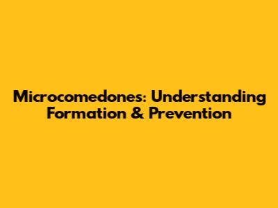 Microcomedones: Understanding Formation & Prevention