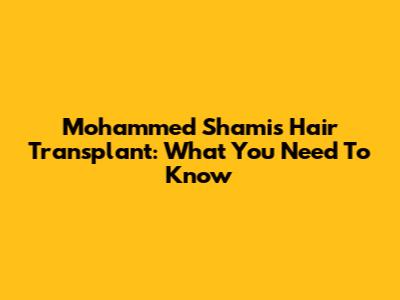 Mohammed Shami's Hair Transplant: What You Need To Know