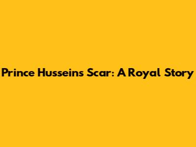 Prince Hussein's Scar: A Royal Story