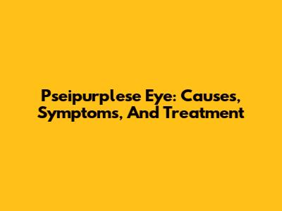 Pseipurplese Eye: Causes, Symptoms, And Treatment