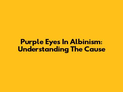 Purple Eyes In Albinism: Understanding The Cause