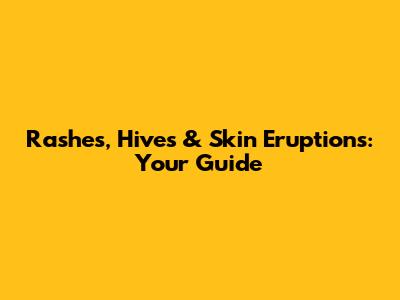 Rashes, Hives & Skin Eruptions: Your Guide