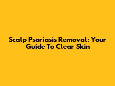 Scalp Psoriasis Removal: Your Guide To Clear Skin