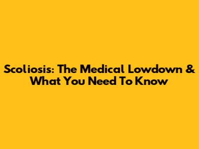 Scoliosis: The Medical Lowdown & What You Need To Know