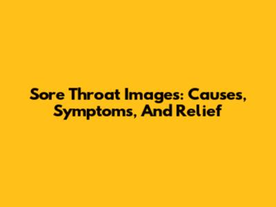 Sore Throat Images: Causes, Symptoms, And Relief